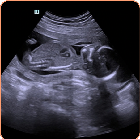 Baby Ara 2026 - 1